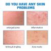 EELHOE Hyaluronic Acid Essence - Hydrating and Repairing, Diminishes Facial Acne Marks, Skin Care Whitening Essence